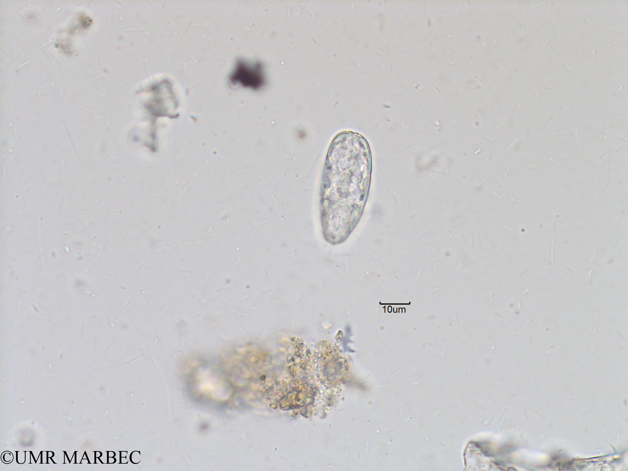 phyto/Bizerte/bizerte_bay/RISCO November 2015/Prorocentrum dactylus (Baie_T5-ACW3-Prorocentrum c lequel-0).tif(copy).jpg